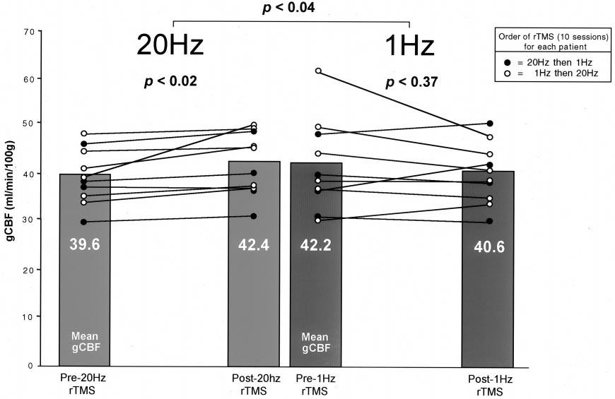 Effects of rtms on rcbf in Depression BIOL PSYCHIATRY 1137 Figure 1.