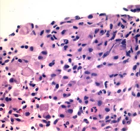 pushed to the cell periphery. Giemsa stain 400x. FIGURE 4.