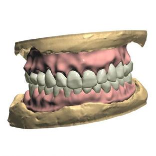 Pala Digital Dentures 2.