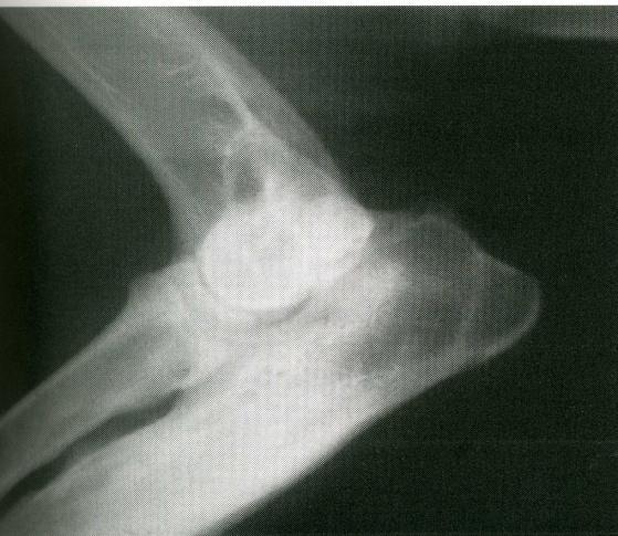 Complications post surgery includes; 1. Infection 2. Failure of the anconeal process to unite and continued lameness Ulna Osteotomy is performed under general anaesthesia.