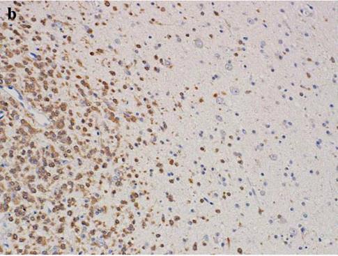 An anti-idh1-r132h-specific monoclonal antibody, IMab-1, is useful for detecting