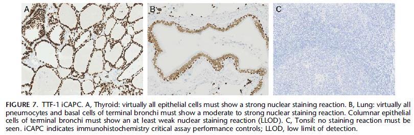 (Right antibody) Low expression
