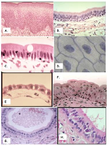 Match the following epithelial tissue types with the image(s) representing them: 9. simple squamous 10. simple cuboidal 11.