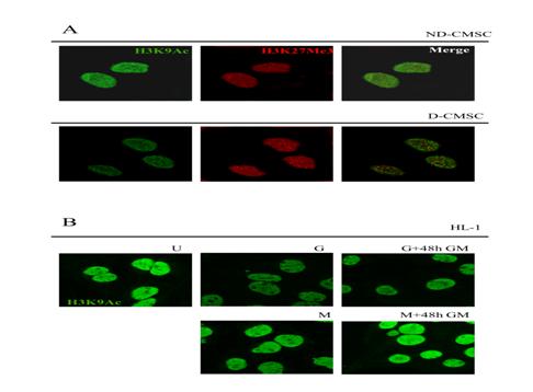 Supplementary Figure 1. (A) Representative confocal analysis of cardiac mesenchymal cells from nondiabetic (ND-CMSC) and diabetic (D-CMSC) immunostained with anti-h3k9ac and anti-h3k27me3 antibodies.