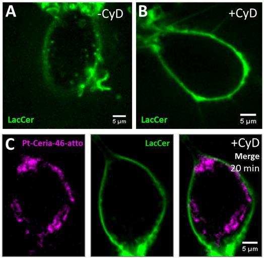 Inhibitor studies Fig. S3 Live-cell confocal study on the influence of caveolin-dependent endocytosis during the uptake of Pt-ceria NPs by HMEC 1 cells.