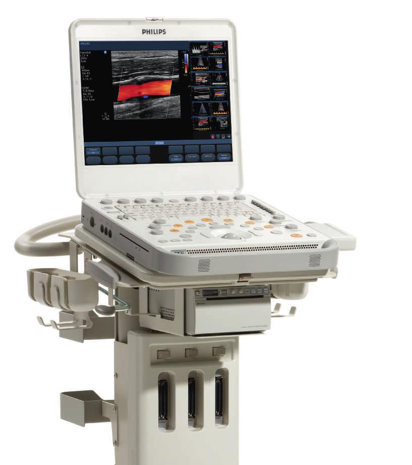 Philips CX30 CompactXtreme Philips CX30 CompactXtreme ultrasound system goes wherever you need it, bringing ultrasound excellence to the bedside and beyond.