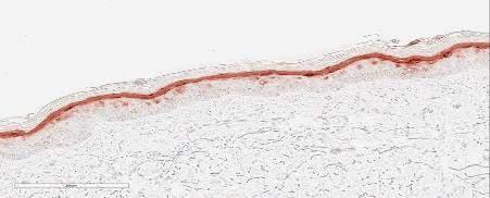00028) in treated skin Filaggrin was calculated considering the stained area and the