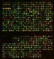 microarrays with 25 000