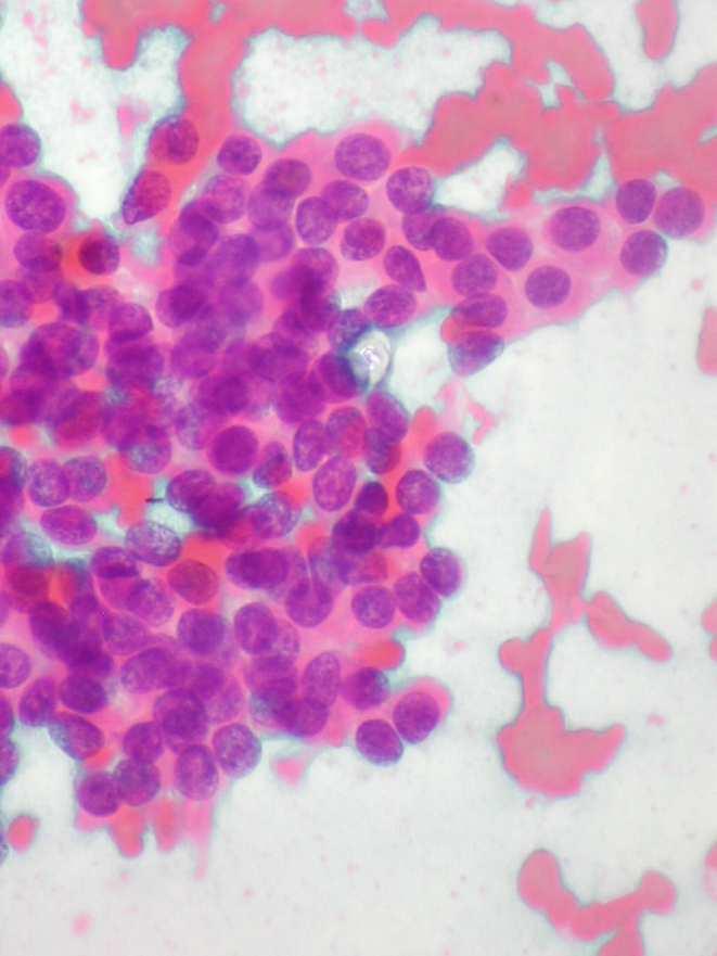 Acinar cells of normal pancreas Plasmocitoma Solid pseudopapillary