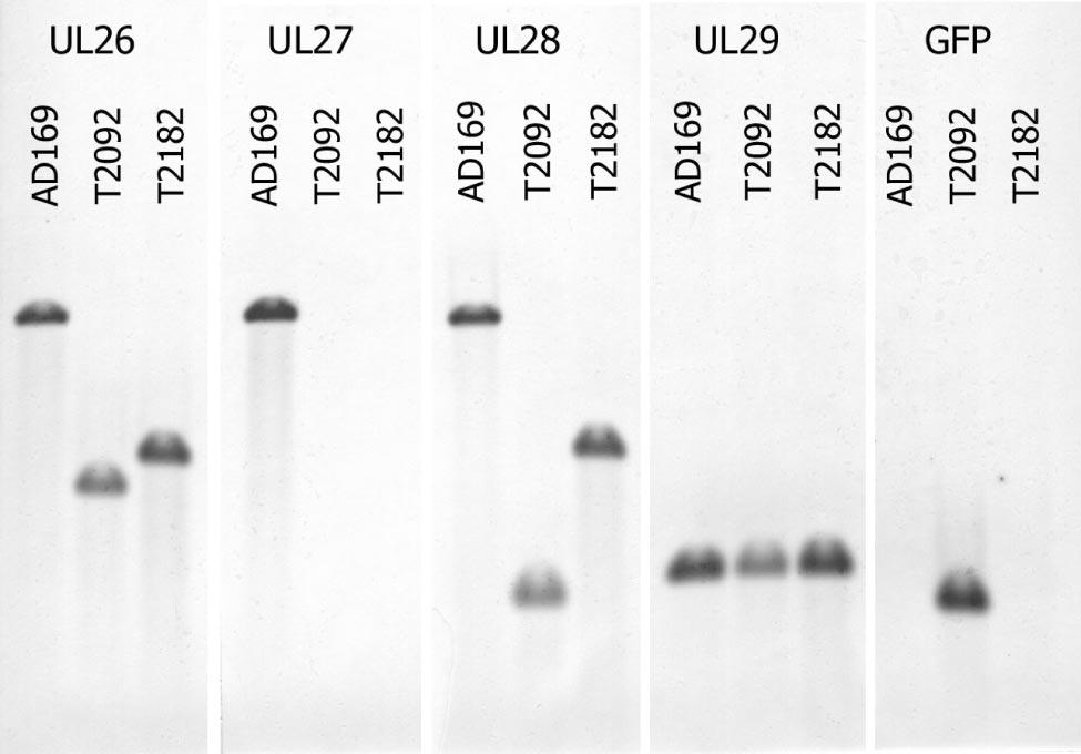 The UL97 fusion protein shows nuclear localization (A), the full-length UL27 fusion protein shows nuclear and nucleolar localization (B), and the fusion protein with UL27 truncated at codon 415 shows