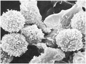 lymphocytes and macrophage