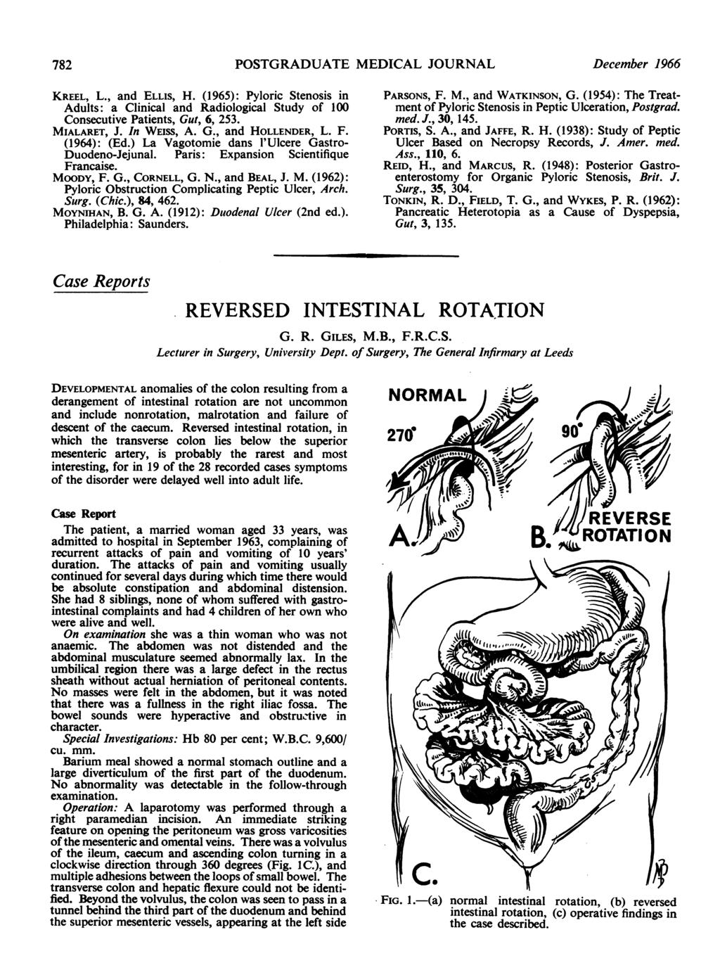 782 POSTGRADUATE MEDICAL JOURNAL December 1966 KREEL, L., and ELLIS, H. (1965): Pyloric Stenosis in Adults: a Clinical and Radiological Study of 100 Consecutive Patients, Gut, 6, 253. MIALARET, J.