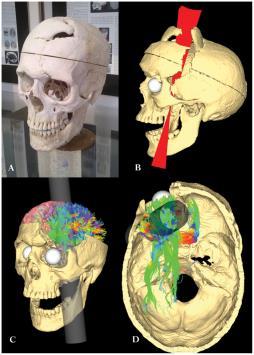 People lie Researcher biases can influence behavior Ex: Phineas Gage Naturalistic Observation