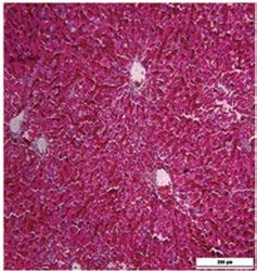 histopathology in the TAA + high-dose aspirin group at wk 12; and F: Liver histopathology in the TAA + enoxaparin group at