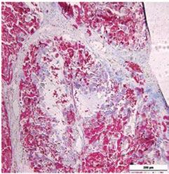At the 12th week, the rat model of liver cirrhosis was successfully established.