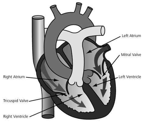 Disorders of the Heart Valvular heart disease Etiology/pathophysiology Heart valves are compromised and do not open and close properly Stenosis: means to stiffen