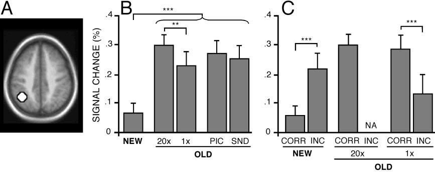 3874 J. Neurosci., May 1, 2003 23(9):3869 3880 Wheeler and Buckner Components of Remembering Figure 4. Left parietal cortex increased activity for OLD responses. Format is similar to that of Figure 3.
