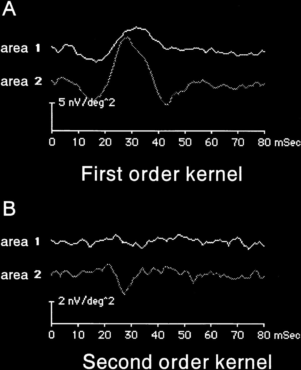 518 Jpn J Ophthalmol Vol 45: 516 522, 2001 Figure 2. (A) Averages of local first order responses of multifocal electroretinogram (M-ERG) in case 1.