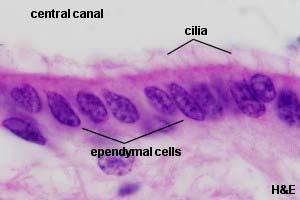 4 Ependymal cells ---structure cuboidal or low