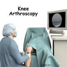 Investigations Osteoarthritis is primarily diagnosed by its clinical presentation.