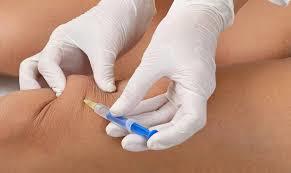 Hyaluronate injections Hyaluronan is an endogenous molecule found in the synovial fluid.