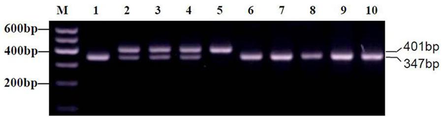 Figure 1. Identification of the PER3 genotypes in 10 flight cadets. 2.5% Agarose gel electrophoresis of PCR amplification products of the 18th exon of PER3 in 1 TAE buffer.