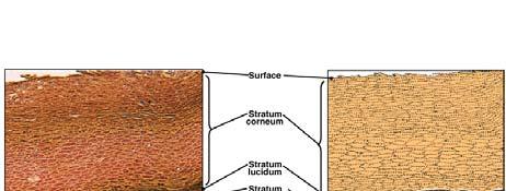 surface Stratum basale