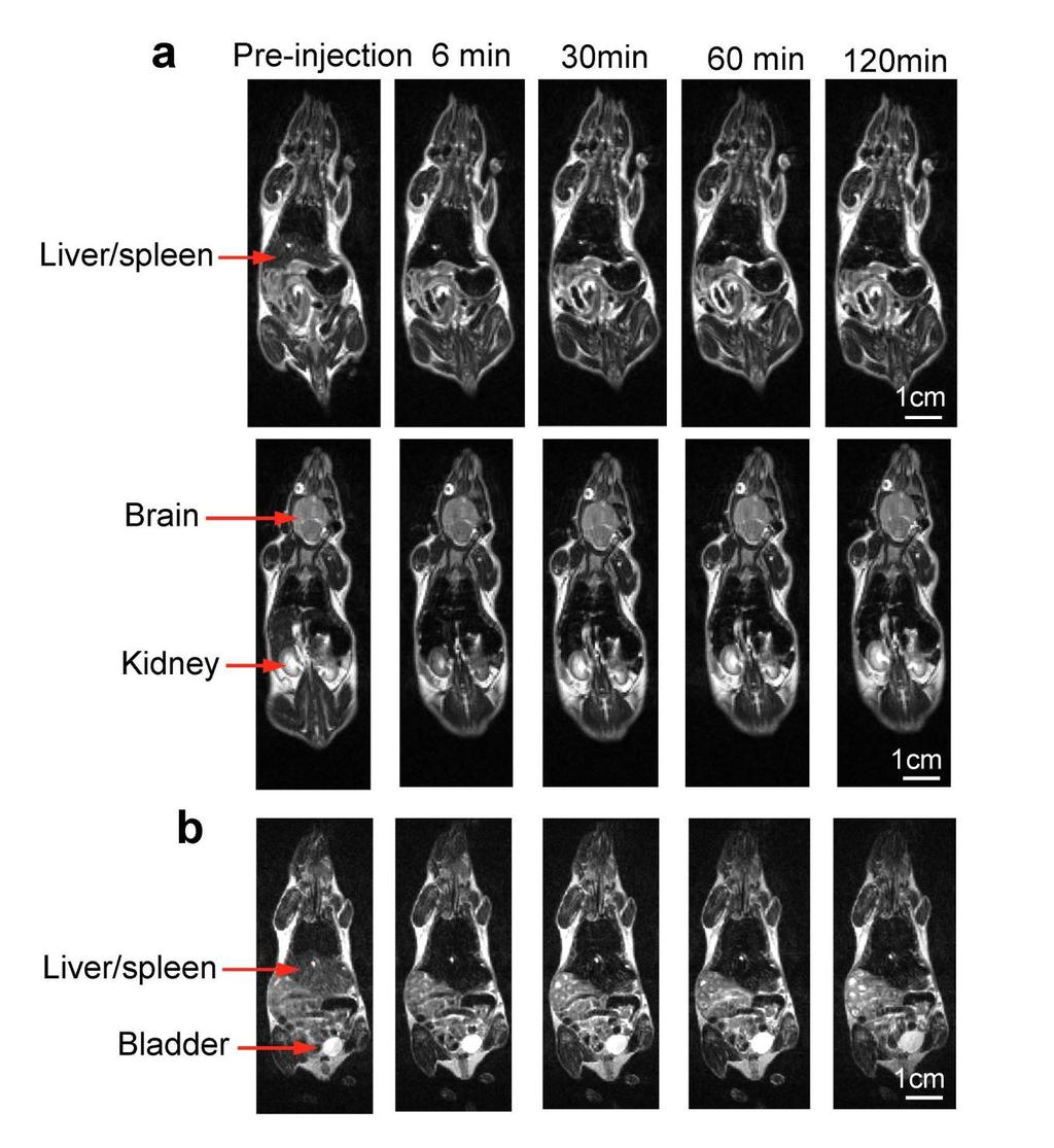 Supplementary Figure 4 MPs in live mice. a, b, Coronal T2-weighted magnetic resonance images before and after injection of MPs in mouse 1 (a) and 2 (b).