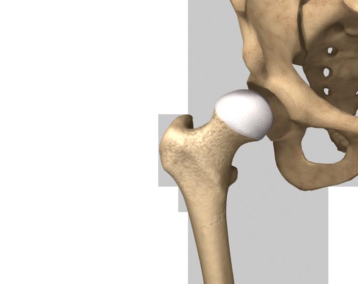 Periacetabular Osteotomy (PAO) At the top of your thigh bone, the femur, is a ball shaped structure called the femoral head, which fits in a socket in the pelvis, called the acetabulum.