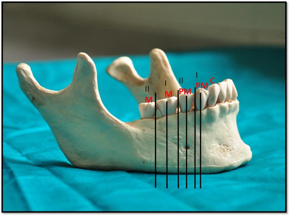 LOCATION A-F (Alveolar Crest to foramen) B-F (Lower border to foramen) C-F (Symphysis Menti to foramen) D-F (Posterior border of ramus to foramen) Int J Anat Res 2017, 5(3.3):4343-48.