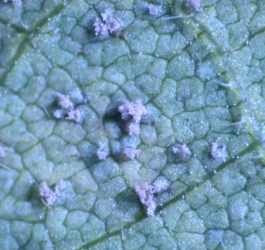 Mixture of young and old pustules on lower