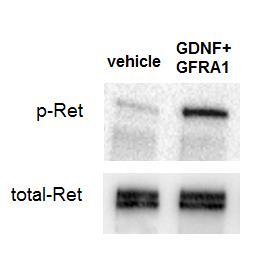 Supplementary Figure 5 Supplementary Figure 5 GDF15 does not activate RET phosphorylation in SH-SY5Y cells overexpressing GFRAL and RET.
