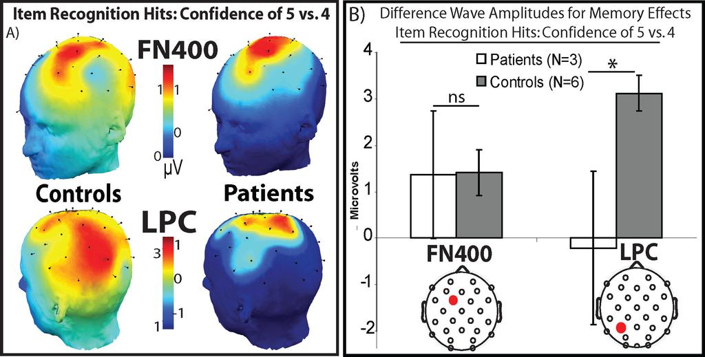 Addante et al. Page 23 Figure 5. Topographic Distribution and Quantification of FN400 and LPC effects A) Scalp topographies are plotted for the average amplitude of ERP differences between high vs.