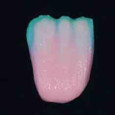 Incisal OE 1 Opal Effect Sky Flu Inside 1 TC Dentine Intensive Dentine 2