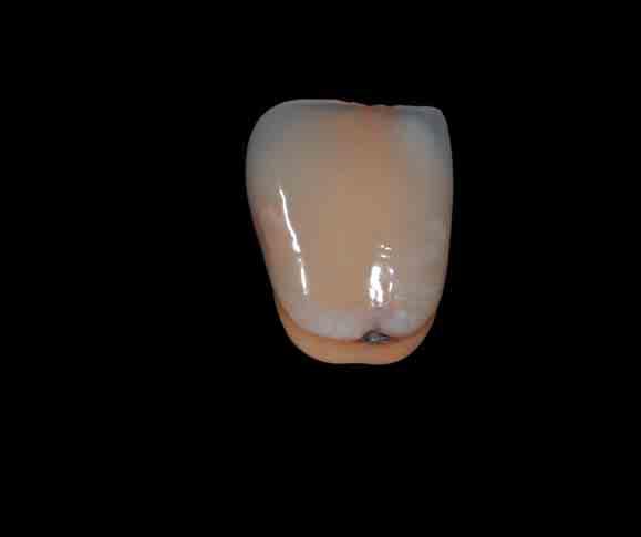 Incisal Opal Effect Ocean Opal Effect Sunrise Flu Inside 2 Intensive Dentine 4 Intensive Dentine 3 Intensive Dentine 2 Dentine Intensive Dentine 3 TC Opal Effect Fog Intensive Dentine 2 The result