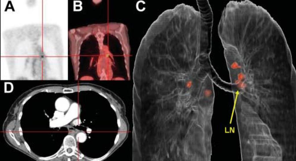 Multi-modality viewing 3D-rendered PET/CT aiding spatial