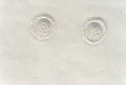 Figure 1: Oocytes at the late stages of development, devoid of layers of cumulus cells and having germinal vesicle clearly vidsible.