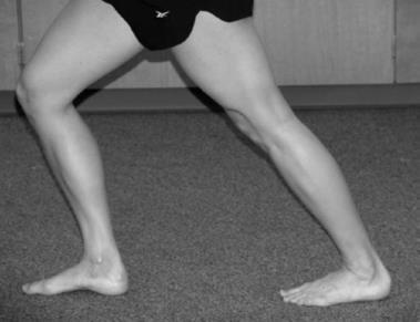 Foot orthoses and stretching may be effective Cohort study 1 23 participants with MTSS run >