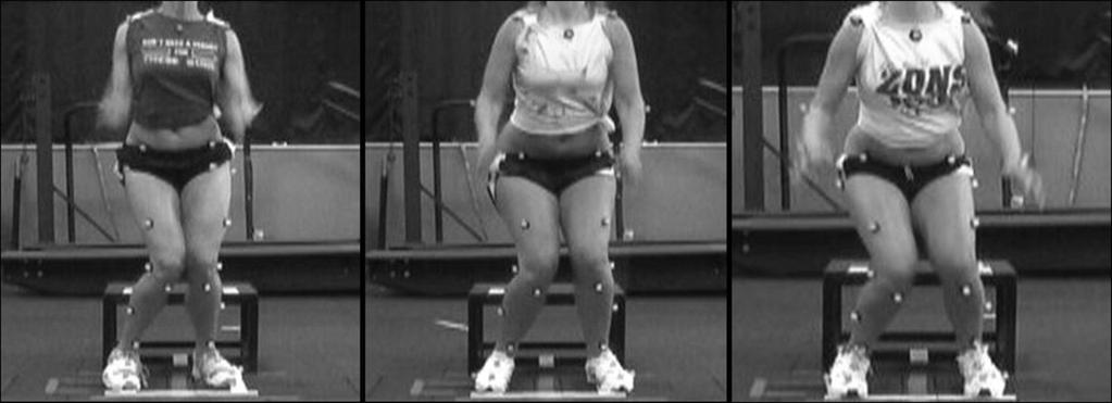 Neuromotor Differences Context of ACL literature Altered