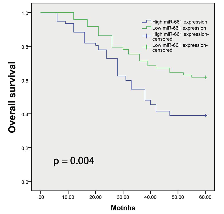 Serum mir-611 in NSCLC Table II. Univariate and multivariate analysis of overall survival in 150 patients with NSCLC. Univariate analysis Multivariate analysis Variable HR p-value HR p-value Age 1.