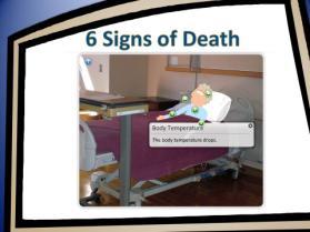 Six Signs of Death How do you know when a resident has