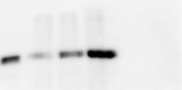 Probe: PrP C Protein tyrosine phosphatase A pm PO 4 - release/µg/min