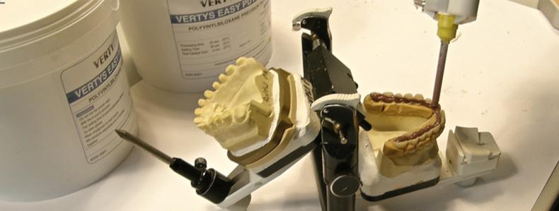 reported the duplicate in the articulator, without damaging the abutments Make any changes to the resin