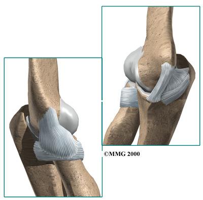 In the elbow, articular cartilage covers the end of the humerus, the end of the radius, and the end of the ulna. Ligaments and Tendons There are several important ligaments in the elbow.