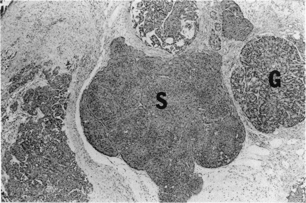 crine pancreas has been accumulated in recent years with the use of rodent models, and we have attempted to define criteria for proliferative lesions of the exocrine pancreas (of the rat) that is
