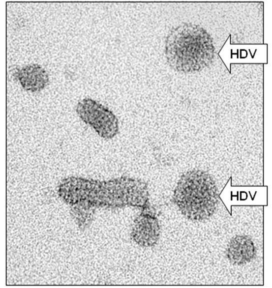Member of the genus Deltavirus 8 major clades (HDV-1 to HDV-8) Hepatitis D Virus (HDV) Genetic variability ranges from 20 to 35% 36 nm defective viral particle; needs HBV to replicate (coinfection or