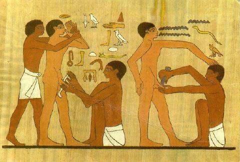 Male circumcision: historical perspective Male circumcision (MC) is associated with various cultural factors: traditional or religious practices rites of passage into adulthood promotion of hygiene