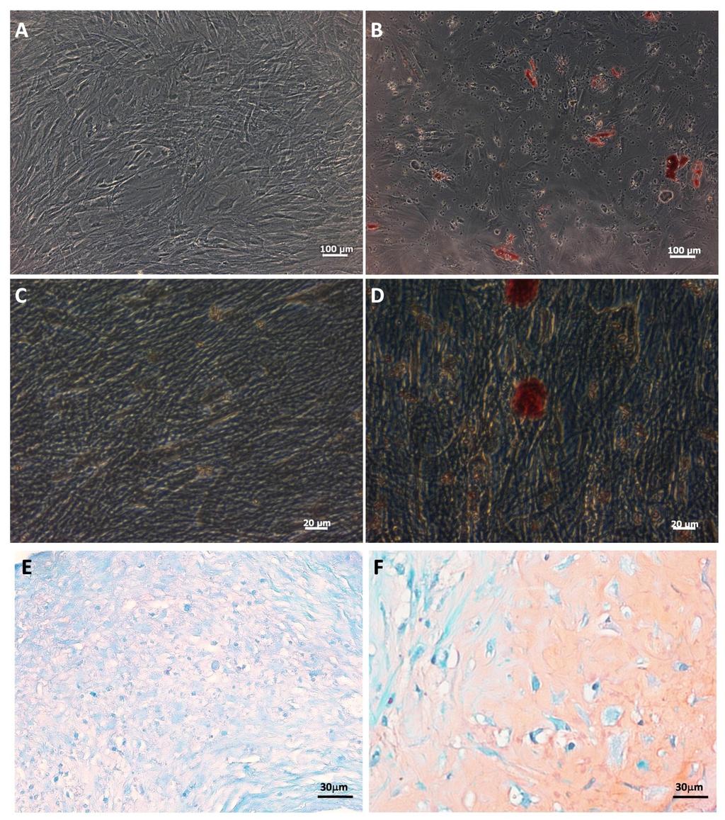 Processing of Lipoaspirate Samples for Optimal Mesenchymal Stem Cells Isolation 195 Fig. 9. In vitro multipotentiality of adipose tissue mesenchymal stem cells.