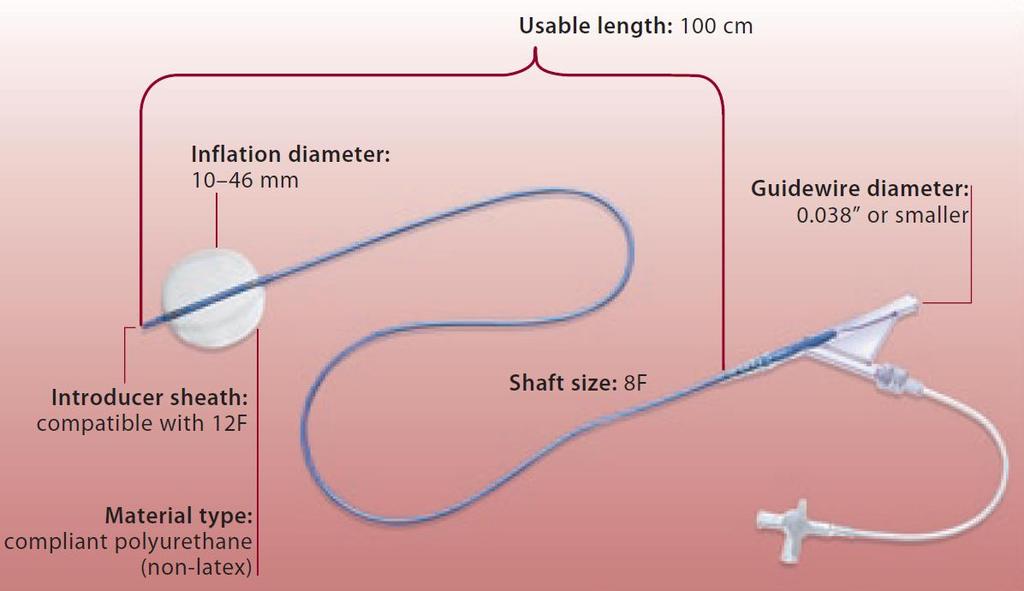 Fogarty catheter Insertion of Fogarty-Catheter in Surgery IVC via time confluence in min (median) of gonadal vein 283 Mobilising the thrombus infradiaphragmatically while using Blood transfusions