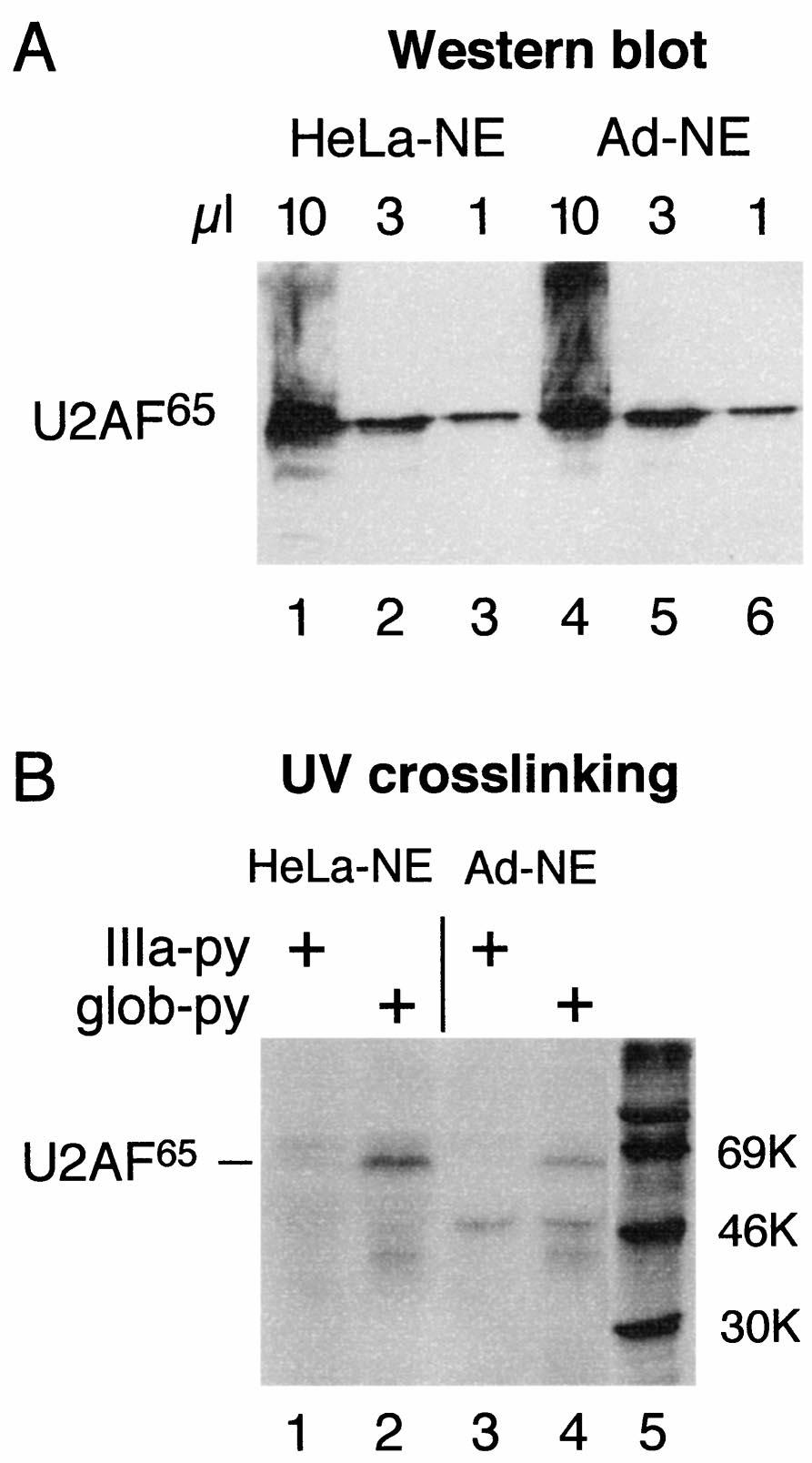 (B) The indicated pre-mrnas were incubated in HeLa-NE or Ad-NE, and splicing products were resolved by gel electrophoresis and visualized by autoradiography.
